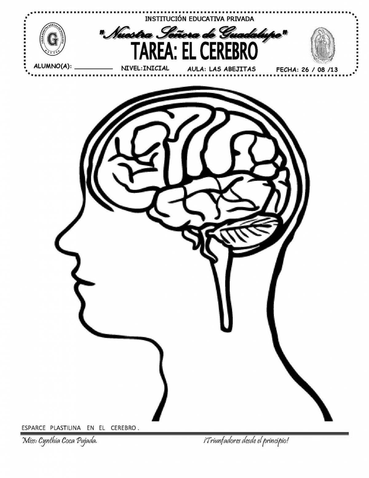 Attractive coloring of the human brain