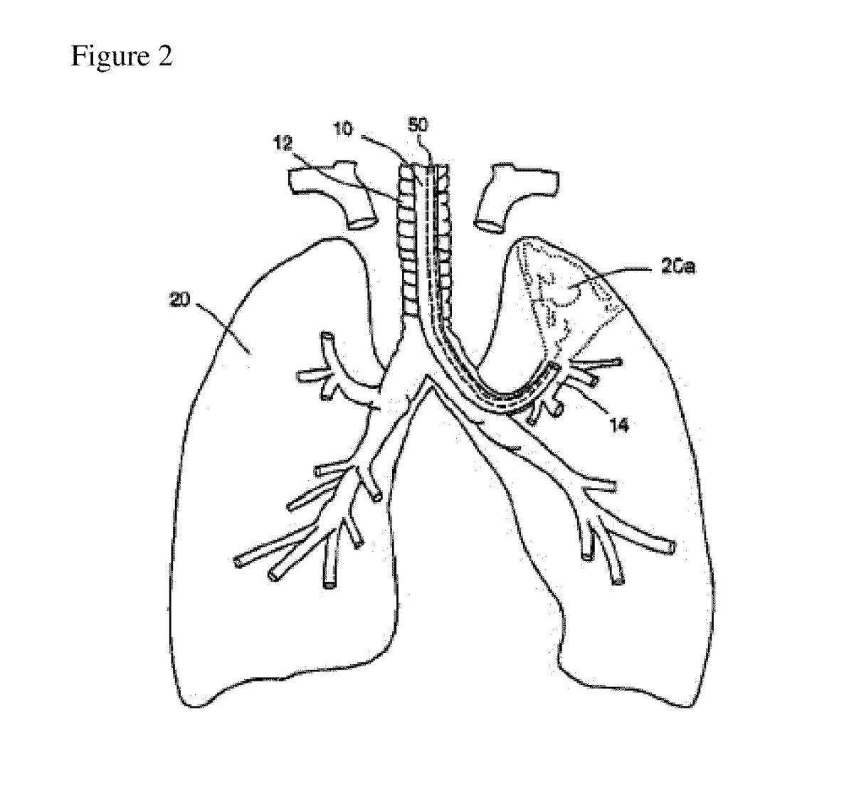 Respiratory system #10