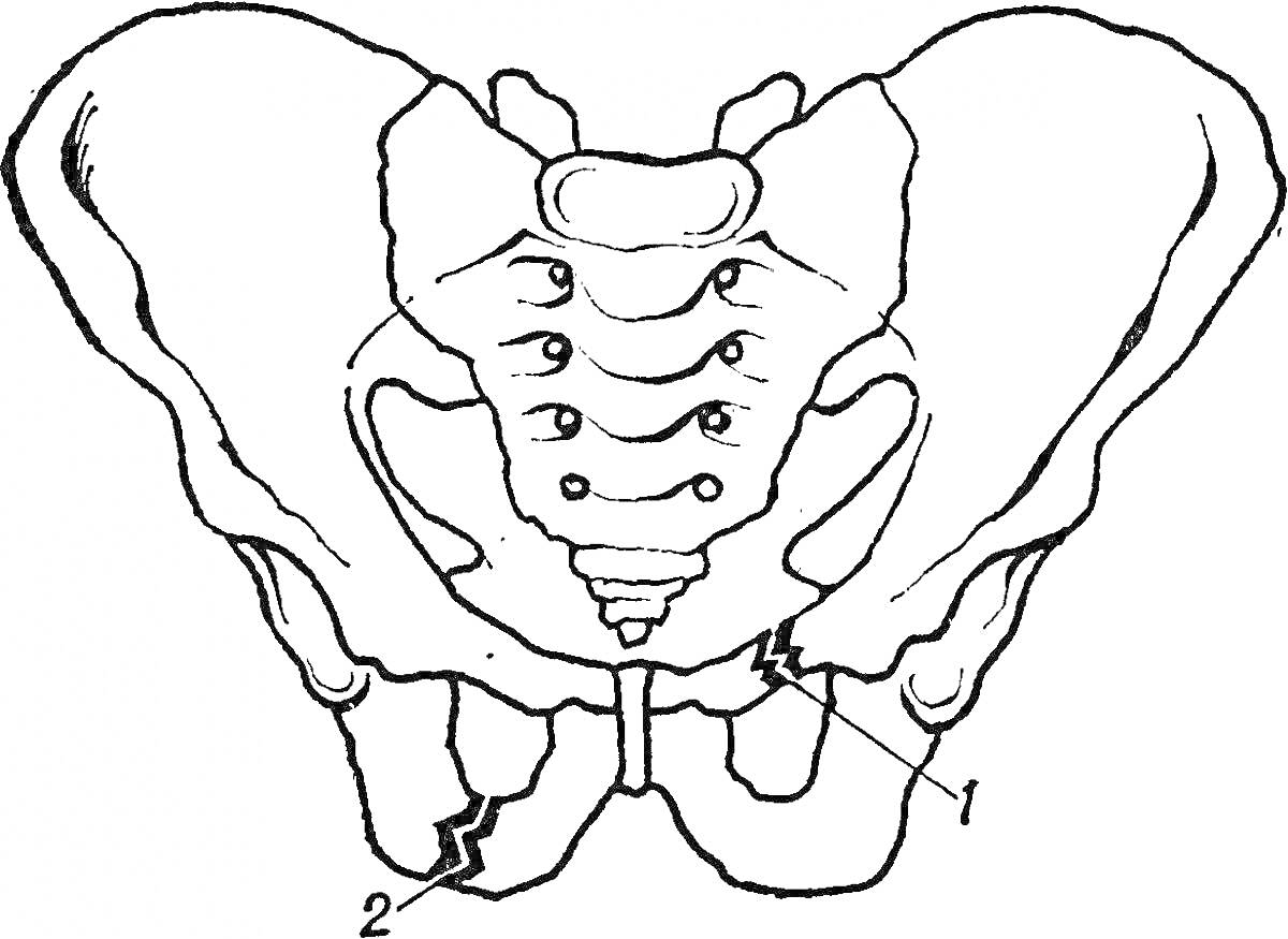 Раскраска Тазовая кость с указанием костных структур