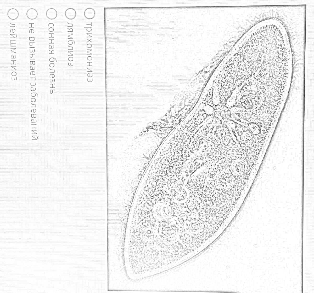 Инфузория туфелька с несколькими пунктами для выбора: трихомониаз, амебиаз, сонная болезнь, не вызывается заболеваниями, лейшманиоз