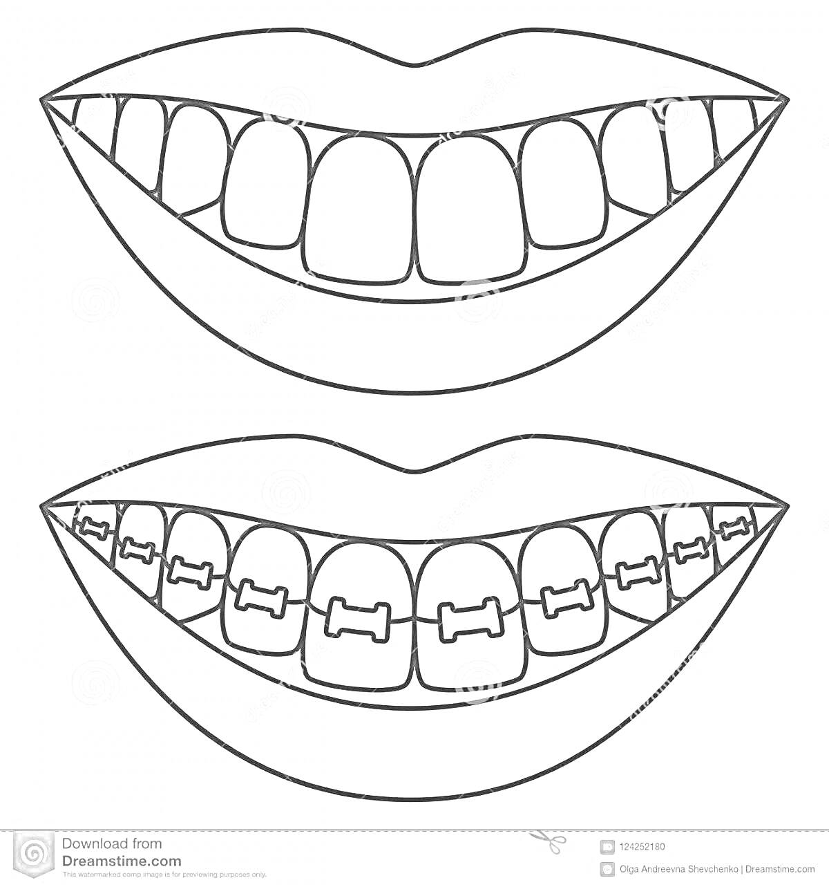 Раскраска Улыбка с зубами и улыбка с брекетами