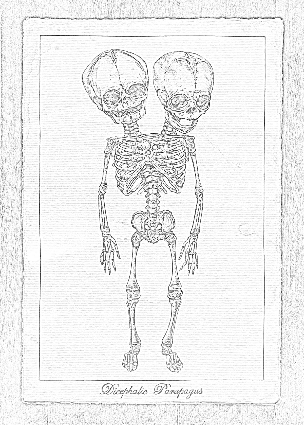 Раскраска Скелет сиамских близнецов с двумя головами на коричневом фоне