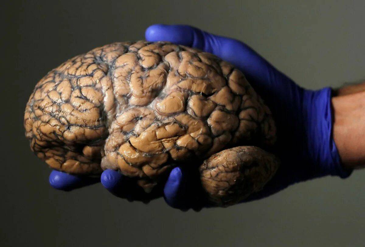 Мозг человека #7