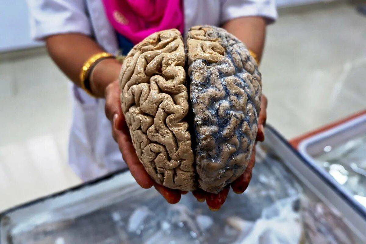 Мозг человека #12