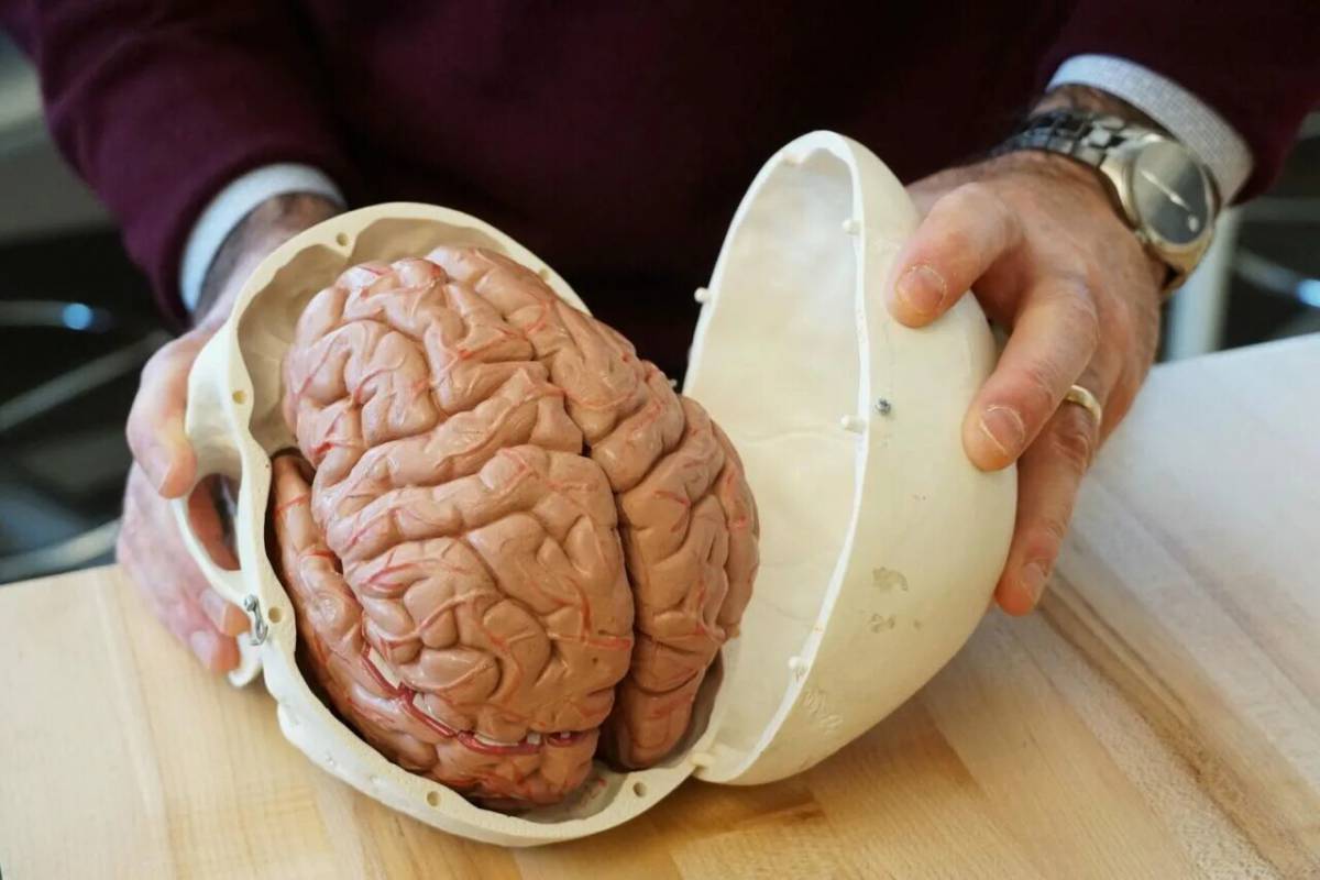 Мозг человека #14