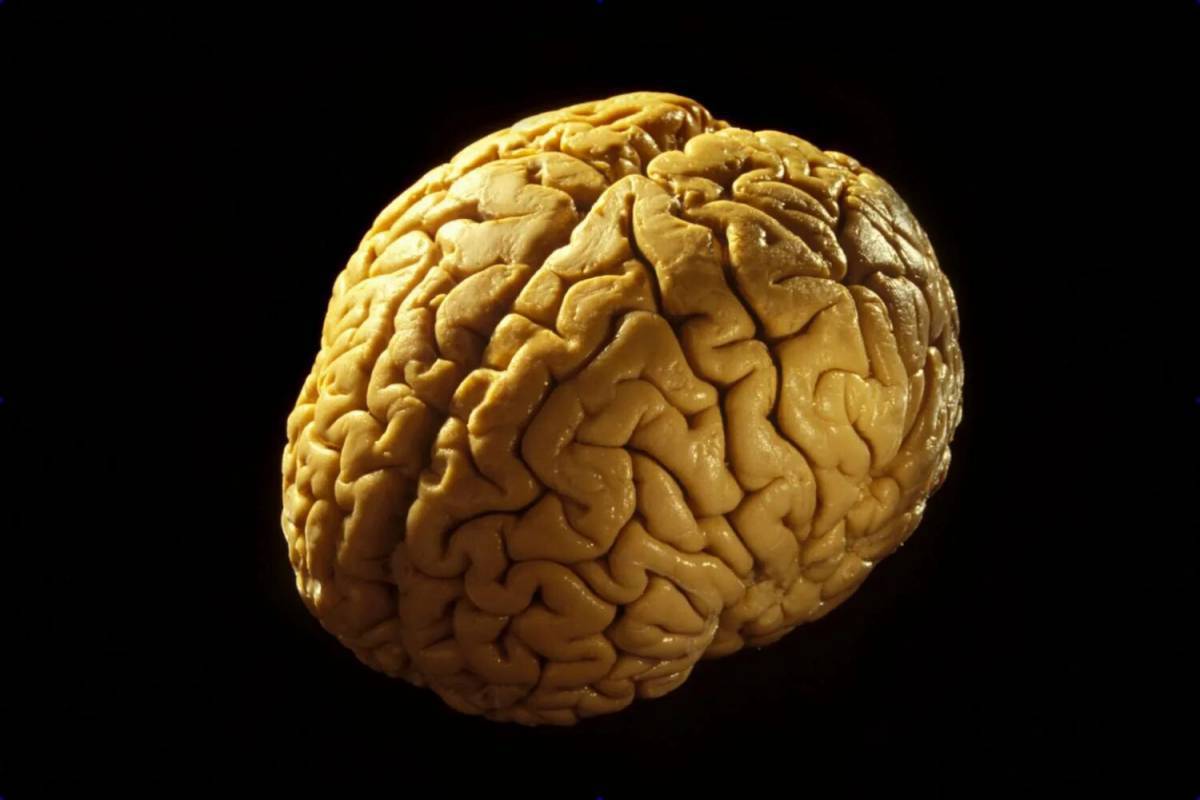 Мозг человека #23