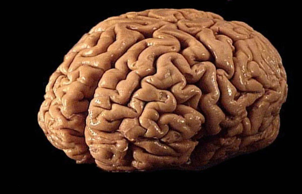 Картинка про мозг. Извилины мозга.